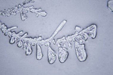 Gözyaşları mikroskop görüş. Büyütme 100-1000 x