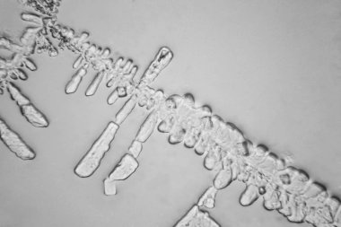 Gözyaşları mikroskop görüş. Büyütme 100-1000 x