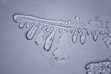 Gözyaşları mikroskop görüş. Büyütme 100-1000 x