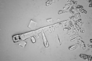 Gözyaşları mikroskop görüş. Büyütme 100-1000 x