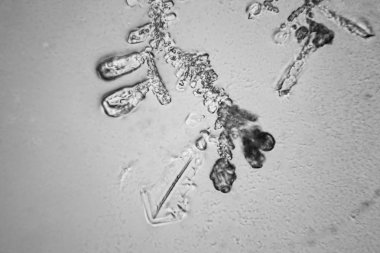 Gözyaşları mikroskop görüş. Büyütme 100-1000 x