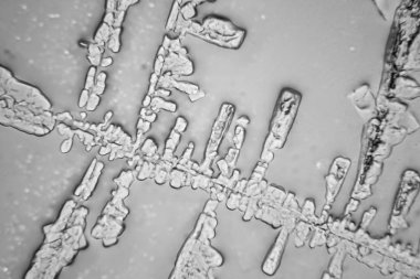 Gözyaşları mikroskop görüş. Büyütme 100-1000 x