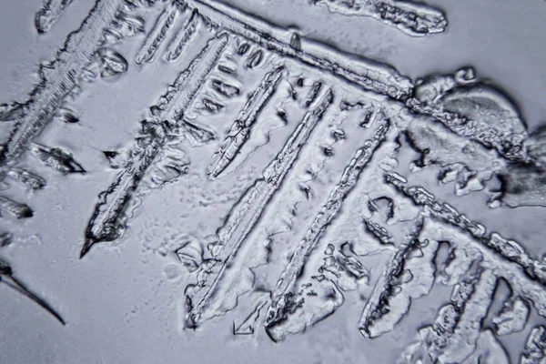 Lágrimas Vistas Microscópio Ampliação 100 1000X — Fotografia de Stock