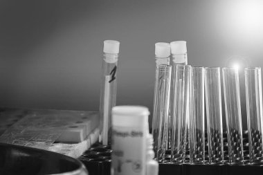 Corona COVID19 SARS gibi bulaşıcı hastalıklar için yapılan laboratuvar testleri. Kelejora. Asansol. Hindistan. Asya. Ağustos 2020.