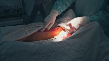 Ameliyatı Koroner arter baypas greftleme operasyon ameliyathane için