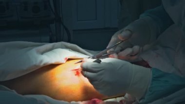 Cerrahlar bir tiyatrodan hasta bir ayak üzerinde çalışıyor