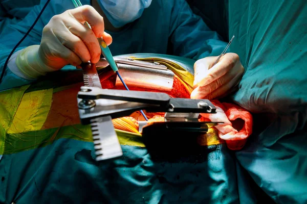 Cirujano Hace Que Cirujano Sala Operaciones Con Operación Sangre — Foto de Stock