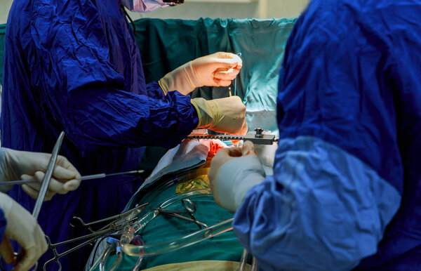 Surgeon themselves inside the wound with surgical instrument during the open heart operation