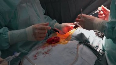 Cerrahlar ameliyat kalp çalışma canlı çekim ekibi