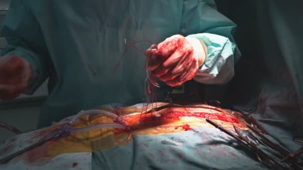 Uzavření hrudníku po operaci srdce