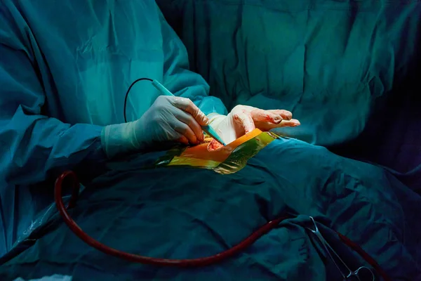 Surgery operating room with medical team of surgeons in hospital surgical — Stock Photo, Image