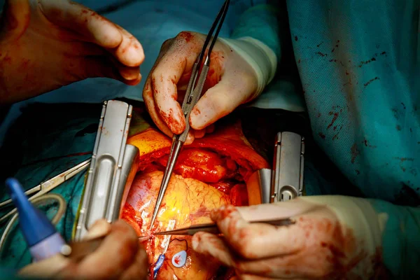 Cirujanos trabajando con una tijera en un paciente en un quirófano —  Fotos de Stock