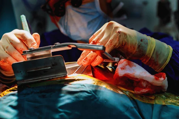 Chirurg provozu živě zastřelil chirurgové tým provozní srdce. — Stock fotografie