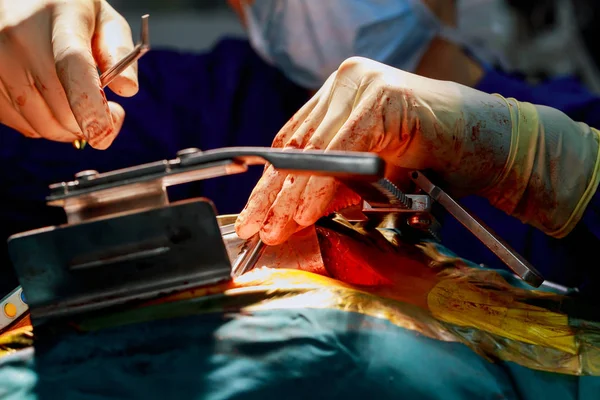 心臓手術。オープン ハート外科縫合大伏在静脈 — ストック写真