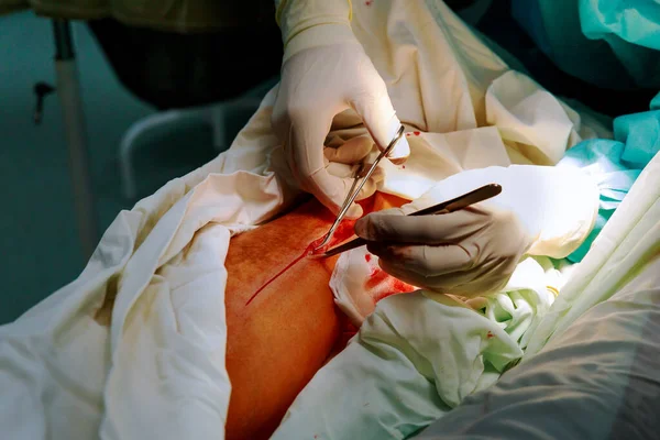 Orvos a műtőben, sebészeti lábműtéti klinika. — Stock Fotó