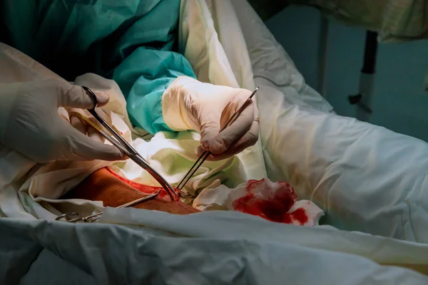 Preparação de cirurgiões em centro cirúrgico com cirurgia para perna — Fotografia de Stock