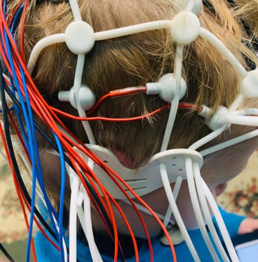 Elektroansefalogram sırasında kafasında elektrotlar olan küçük bir çocuk.