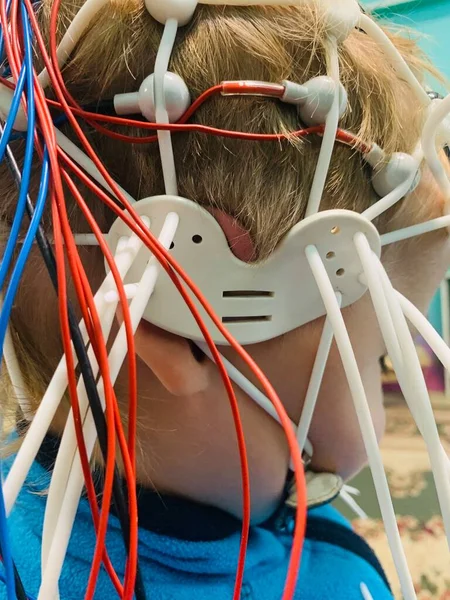 Close Head Little Boy Electroencephalogram Brain Activity Check Electrodes — Stock Photo, Image