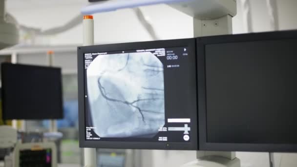 Монітор екрану в радіології під час операції на серці . — стокове відео