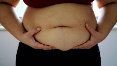 salvador, bahia / brazil - june 10, 2020: woman holds her belly where there is accumulation of abdominal cordura in the city of Salvador.
