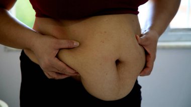 salvador, bahia / brazil - june 10, 2020: woman holds her belly where there is accumulation of abdominal cordura in the city of Salvador.
