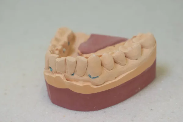 Plaster Model Lower Teeth — Stock Photo, Image