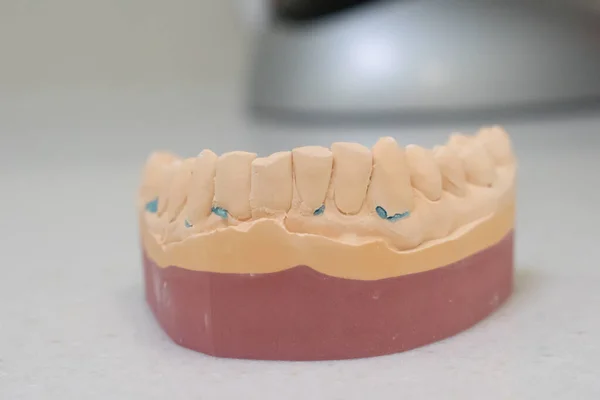 Cast Plaster Model Teeth Dentistry — Stock Photo, Image