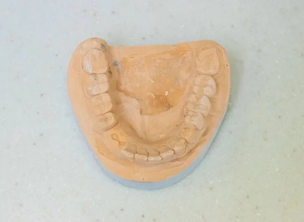 Cast Plaster Model Teeth Top View — Stock Photo, Image