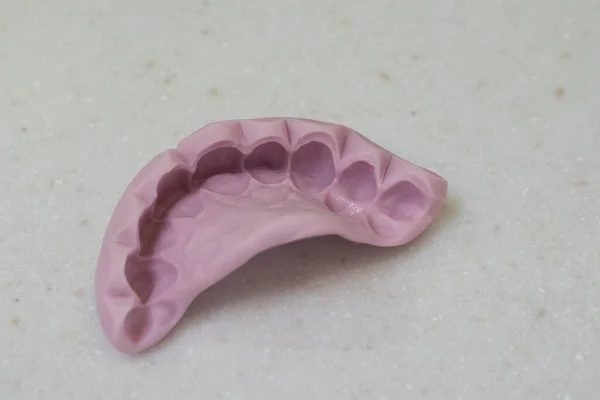 Plantilla Quirúrgica Impresión Silicona Dientes Odontología — Foto de Stock