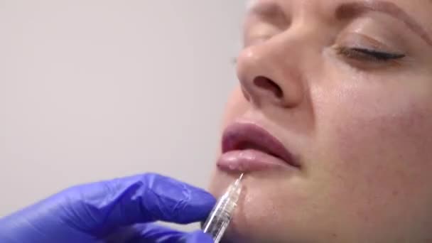 Girl Plastic Operation Medical Clinic Doctor Does Lip Augmentation Surgery — Stock Video