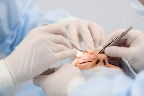 Blefaroplasti, plastik cerrahi operasyon kusurları, deformiteleri ve göz kapakları disfigurations düzeltmek ve estetik yüz göz bölgesini değiştirmek için. tıbbi klinikte