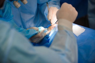 lazer Blefaroplasti, defektleri düzeltmek için plastik cerrahi operasyon, deformiteler, ve göz kapaklarının disfigurations; ve estetik olarak yüzün göz bölgesini değiştirmek için. tıbbi klinikte