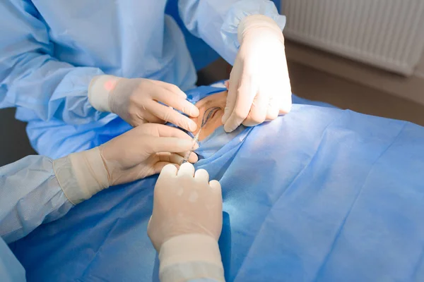 Blefaroplastia a laser, cirurgia plástica para correção de defeitos, deformidades e desfigurações das pálpebras; e para modificar esteticamente a região ocular da face. na clínica médica — Fotografia de Stock