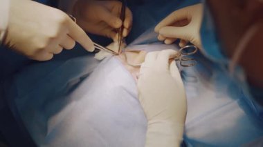 Tıbbi klinikte yüz bölgesinin değiştirilmesi için Blepharoplasty estetik ameliyatı. İki doktor kadınlar için estetik ameliyat yapıyor. Cerrah göz kapağına dikiş atar.