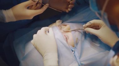 Tıbbi klinikte yüz bölgesinin değiştirilmesi için Blepharoplasty estetik ameliyatı. İki doktor kadınlar için estetik ameliyat yapıyor. Cerrah göz kapağına dikiş atar.