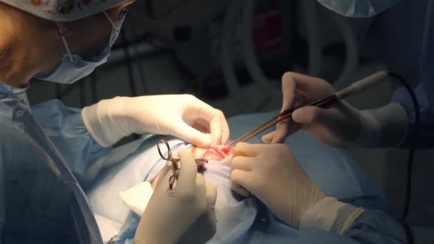 Blefaroplastie Chirurgie Plastică Operație Pentru Modificarea Regiunii Oculare Feței Clinica — Videoclip de stoc