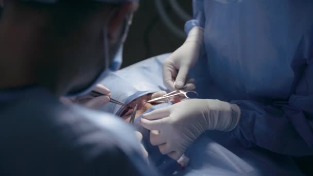 Blefroplastická Plastická Operace Pro Úpravu Oční Oblasti Obličeje Lékařské Klinice — Stock video