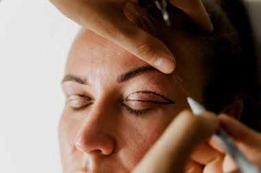 Tıbbi klinikteki yüz bölgesini değiştiren estetik ameliyattan önce yüzünde Blepharoplasti izi var. 2 doktor estetik ameliyat yapıyor.