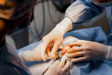Tıbbi klinikte yüz bölgesinin değiştirilmesi için Blepharoplasty estetik ameliyatı. İki doktor kadınlar için estetik ameliyat yapıyor. Cerrah cerrahi bıçakla bir kesik atar.