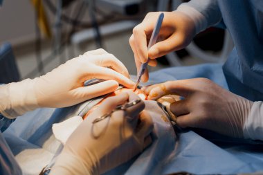 Tıbbi klinikte yüz bölgesinin değiştirilmesi için Blepharoplasty estetik ameliyatı. İki doktor kadınlar için estetik ameliyat yapıyor. Cerrah cerrahi bıçakla bir kesik atar.