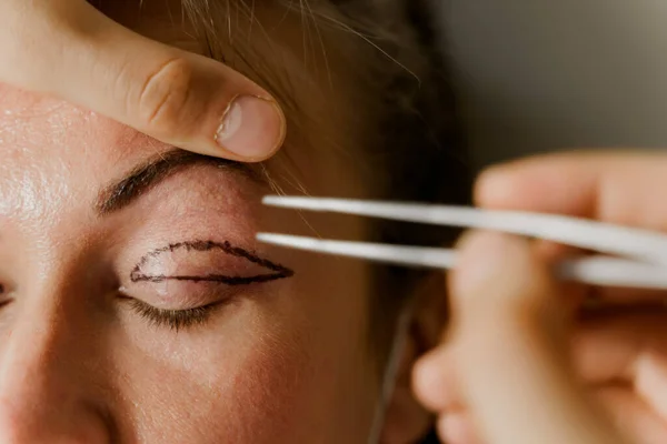 Tıbbi klinikteki yüz bölgesini değiştiren estetik ameliyattan önce yüzünde Blepharoplasti izi var. 2 doktor estetik ameliyat yapıyor.