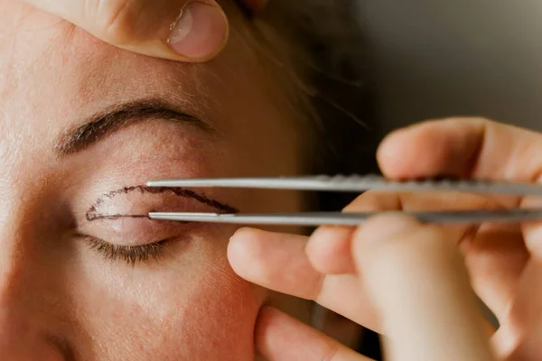 Tıbbi klinikteki yüz bölgesini değiştiren estetik ameliyattan önce yüzünde Blepharoplasti izi var. 2 doktor estetik ameliyat yapıyor.