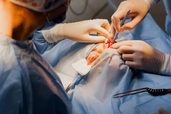 Blepharoplastiek Plastische Chirurgie Operatie Voor Het Wijzigen Van Oogstreek Van — Stockfoto