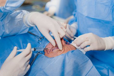 Tıbbi klinikte yüz bölgesinin değiştirilmesi için biyo-faroplasti ve estetik cerrahi operasyonundan önce anesteziyi kapat. Cerrah göz kapağına dikiş atar.