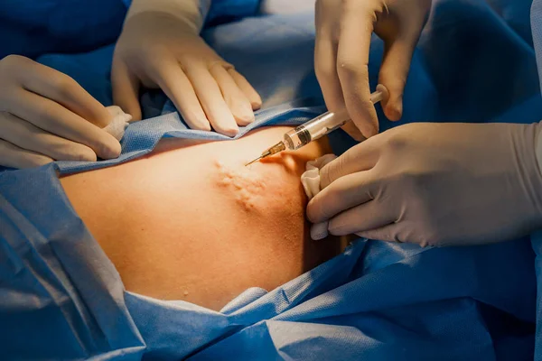 Tıbbi Klinikte Yüz Bölgesinin Değiştirilmesi Için Biyo Faroplasti Estetik Cerrahi — Stok fotoğraf