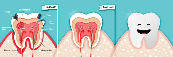 Papírové Umění Zdravotní Vědy Špatném Zubu Dobrém Vektoru Zubu — Stockový vektor
