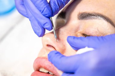 Özel muamele ile donanım yüz temizleme prosedürü.