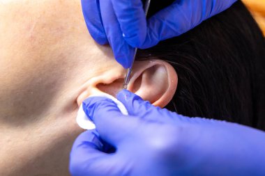 Özel muamele ile donanım yüz temizleme prosedürü.