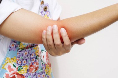 kadın el bileği akut ağrı