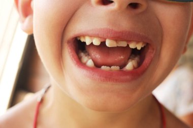 Sütsüz küçük çocuk gülümsüyor. Ağız bakımı, stomatoloji